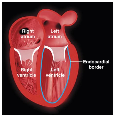 what is lv|what is lv in cardiology.